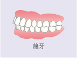 龅牙