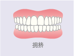 拥挤