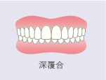 深覆合