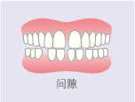 间隙