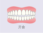 开合