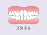牙列不齐